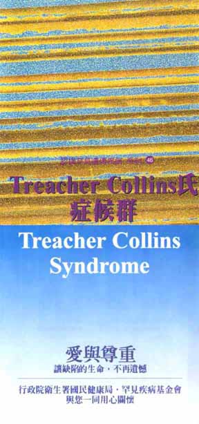 認識罕見遺傳疾病系列(46)Treacher Collins