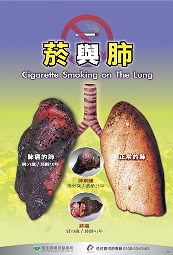 菸與肺文章照片